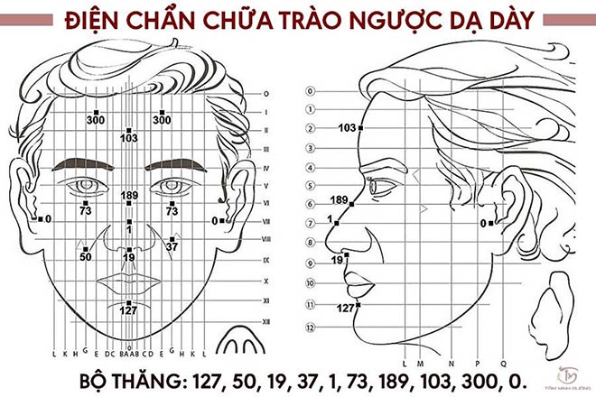3 cách chữa trào ngược dạ dày thực quản lành tính, hiệu quả tại nhà - 4