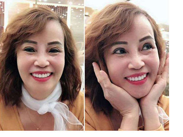 Làm đẹp - "Cô dâu Cao Bằng 62 tuổi" ngoài bơm mỡ còn có thể làm gì để cải lão hoàn đồng?