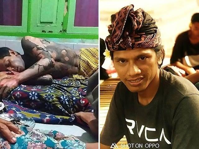 Bạn trẻ - Cuộc sống - Không chịu nói mật khẩu điện thoại, chồng bị vợ thiêu sống