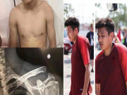 Bóng đá - Sao số 1 Trung Quốc chấn thương ghê rợn, lỡ đại chiến Thái Lan vòng 1/8