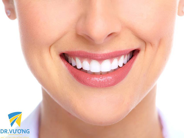 Tư vấn làm đẹp - Tẩy trắng răng đón Tết, nên hay không?