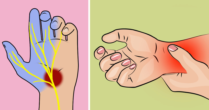 Khi thấy tay hoặc chân thường xuyên bị tê, hãy dè chừng những bệnh nguy hiểm sau - 1