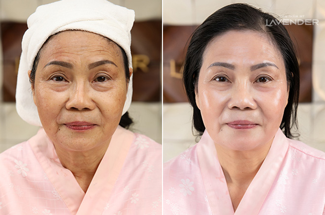 Trào lưu làm đẹp Tết này: "Cải lão hoàn đồng" chỉ trong 60 phút - 2