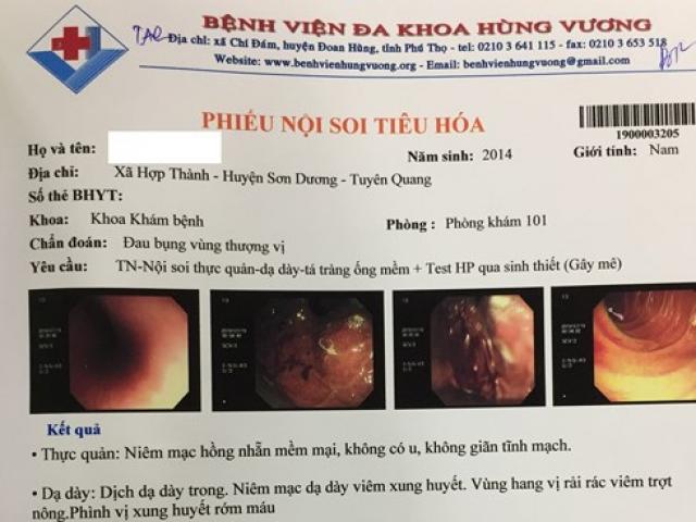 Sức khỏe đời sống - Hôn trẻ nhiều có thể lây vi khuẩn gây ung thư