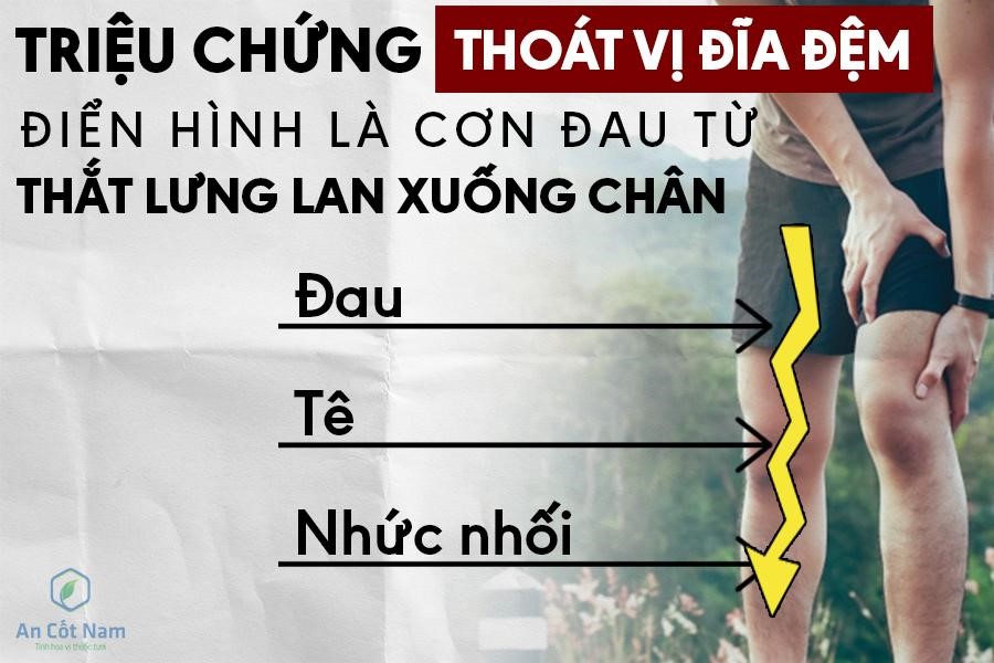 7 triệu chứng thoát vị đĩa đệm thắt lưng đặc trưng theo từng dấu hiệu - 2