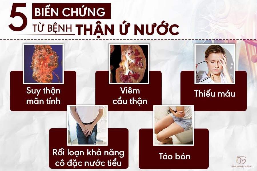 Nguyên nhân thận ứ nước và cách điều trị bệnh an toàn, hiệu quả - 3