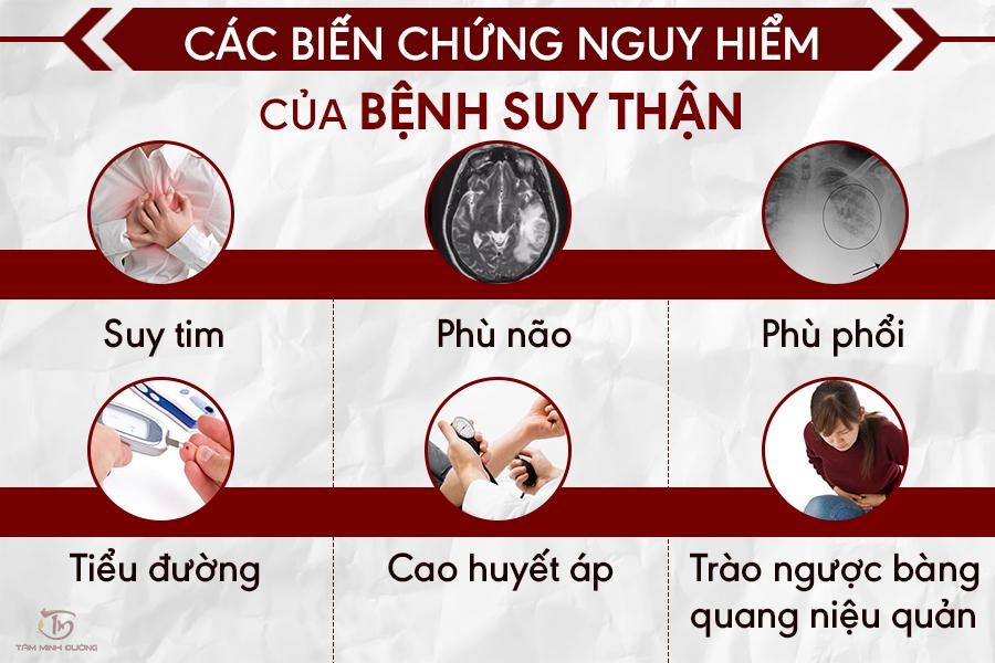 Suy thận độ 1,2,3,4: Mức độ nguy hiểm và cách chữa hiệu quả - 3
