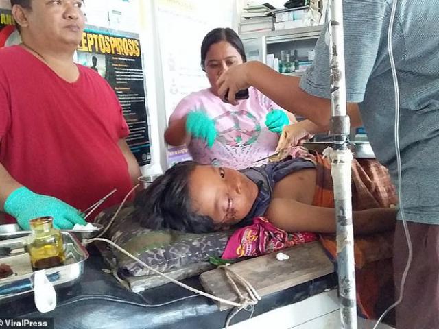 Thế giới - Philippines: Con bị cá sấu lôi xuống nước cắn, cha liền nhảy xuống cắn lại