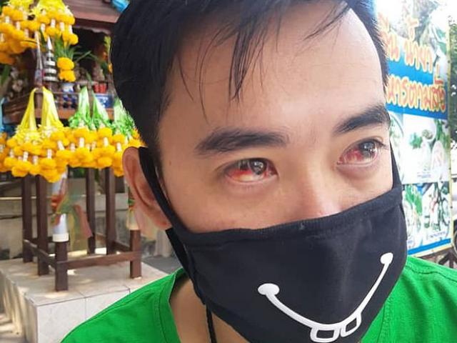 Thế giới - Bangkok tràn ngập khói bụi độc, hắt hơi cũng ra máu