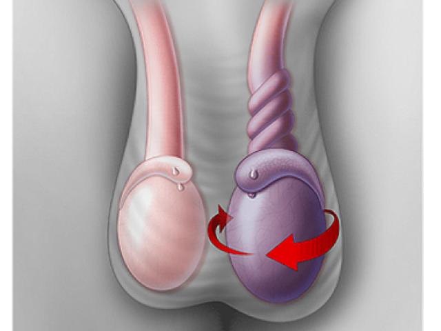 Sức khỏe đời sống - Cuối năm thêm một ca cấp cứu của "biệt đội giải cứu tinh hoàn"