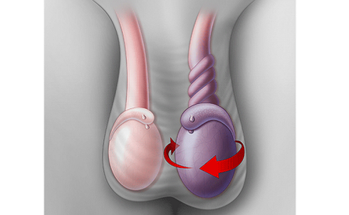 Cuối năm thêm một ca cấp cứu của "biệt đội giải cứu tinh hoàn" - 1
