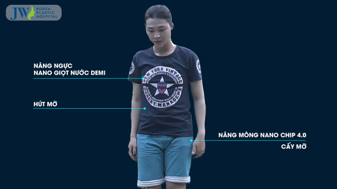 Khi “đàn ông” nâng ngực, nâng mông để thành phụ nữ - 1