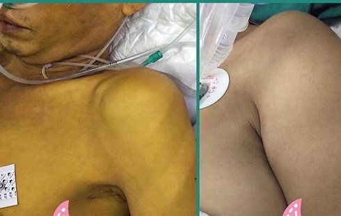Dành cả thanh xuân uống rượu, người đàn ông không qua được tuổi 35! - 1