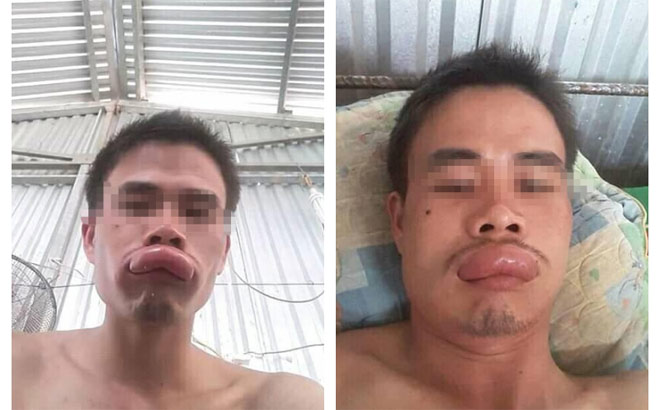 Thanh niên số nhọ tối cuối năm: Đang ngắm chậu hoa mai thì gặp hoạ - 1