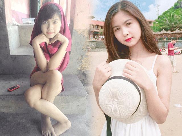 Bạn trẻ - Cuộc sống - Sau 5 năm nổi tiếng "hot girl chân khoèo" lột xác thế này đây!