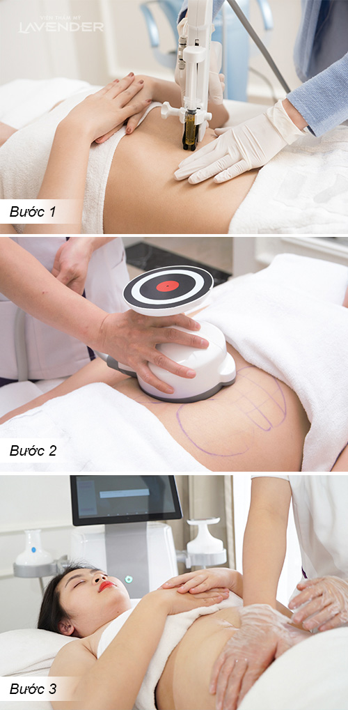 Trào lưu giảm cân siêu hot nào đang được loạt sao áp dụng sau Tết? - 5