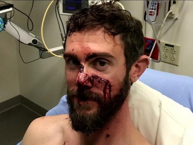 Thế giới - Người đàn ông Mỹ giết chết sư tử núi bằng tay không như thế nào?