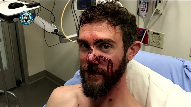 Người đàn ông Mỹ giết chết sư tử núi bằng tay không như thế nào? - 3