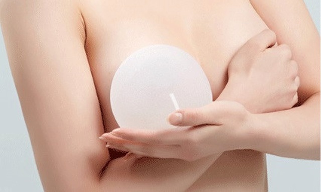 Không chỉ ung thư, còn &#39;hàng tỷ&#39; biến chứng hãi hùng khi nâng ngực - 3