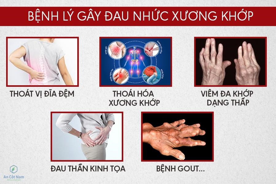 Đau nhức xương khớp toàn thân uống thuốc gì tốt cho người già, người trẻ - 2