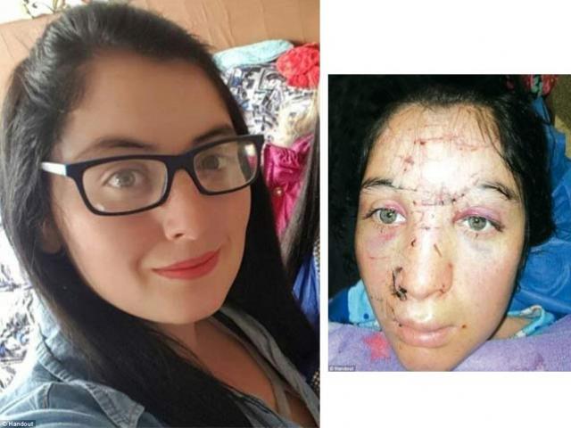 Pháp luật - Từ chối lời cầu hôn, cô gái xinh đẹp bị bạn trai hủy hoại dung nhan