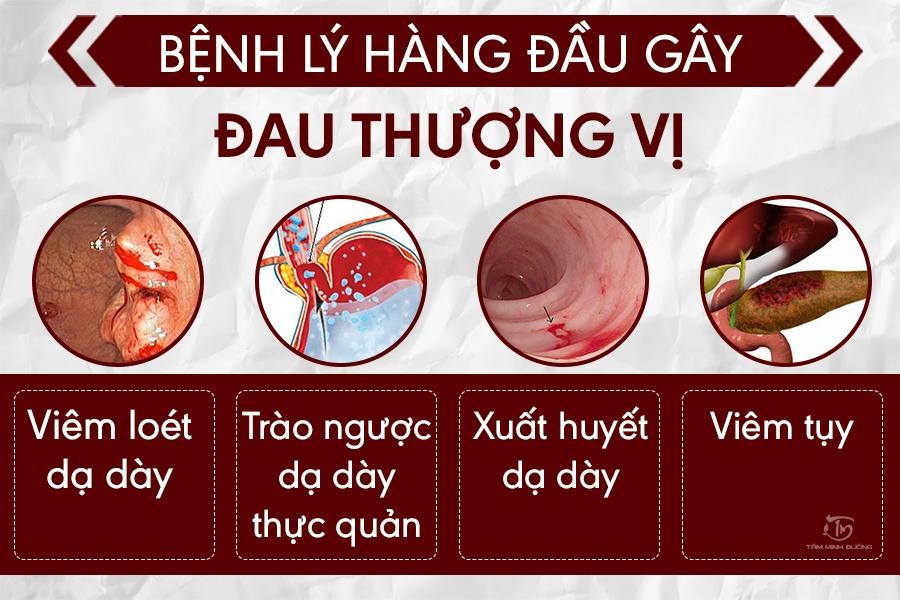 Đau thượng vị dạ dày là gì? Nguyên nhân, dấu hiệu và cách điều trị tại nhà - 2