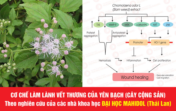 Ai bị đau bao tử (dạ dày) HP hay tái phát: Dùng ngay cây này sẽ không phải hối hận - 4