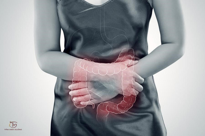 Bệnh viêm đại tràng: Nguyên nhân, dấu hiệu và cách chữa trị - 1