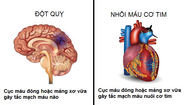 Mỡ máu cao: Thoát khỏi ám ảnh đột quỵ, nhồi máu cơ tim chỉ nhờ cách này - 1