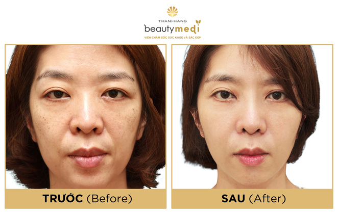 Tiền nhiều để làm gì nếu không sở hữu làn da căng bóng - 5