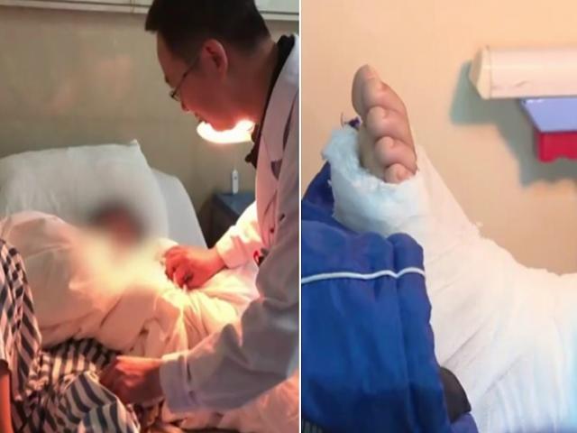 Trung Quốc: Không làm bài tập về nhà đúng giờ, cậu bé bị cha đánh gãy chân