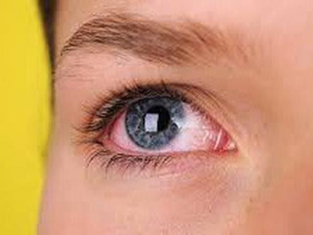 Sức khỏe đời sống - Bệnh gây mù lòa hàng đầu thế giới: Cứ 2 giây có 1 người không nhìn thấy ánh sáng