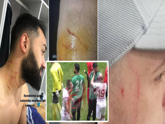 Bóng đá - Cực SỐC bóng đá: Tấn công đối thủ bằng dao, trọng tài... mặc kệ