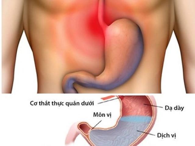 Sức khỏe đời sống - Căn bệnh khiến 7 triệu người khổ sở về đêm