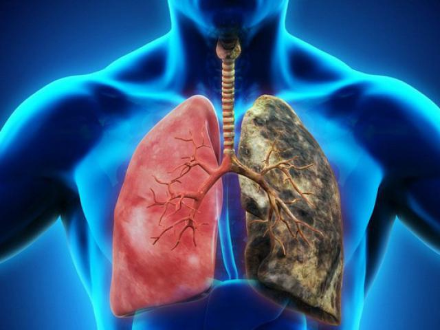 Sức khỏe đời sống - Những dấu hiệu giúp bạn tự phát hiện sớm 10 bệnh nguy hiểm phổ biến nhất hiện nay