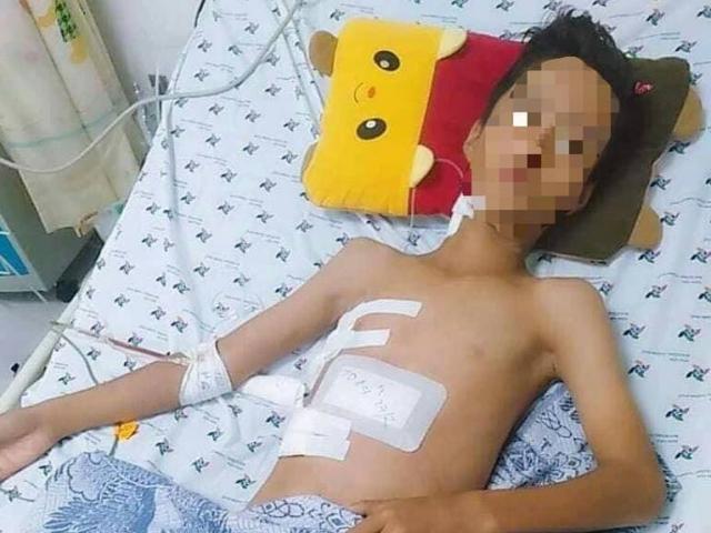 Đi cắt lúa mướn, thiếu niên 13 tuổi bị cây sắt đâm xuyên từ bụng đến ngực
