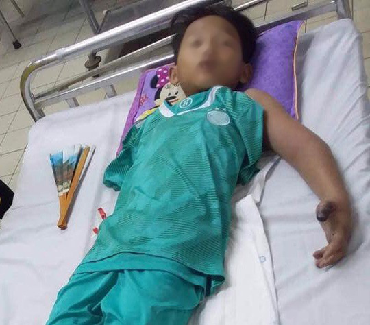 Nóng 24h qua: Tài xế khai nguyên nhân gây tai nạn làm bác sĩ, thiếu tá công an tử vong - 3