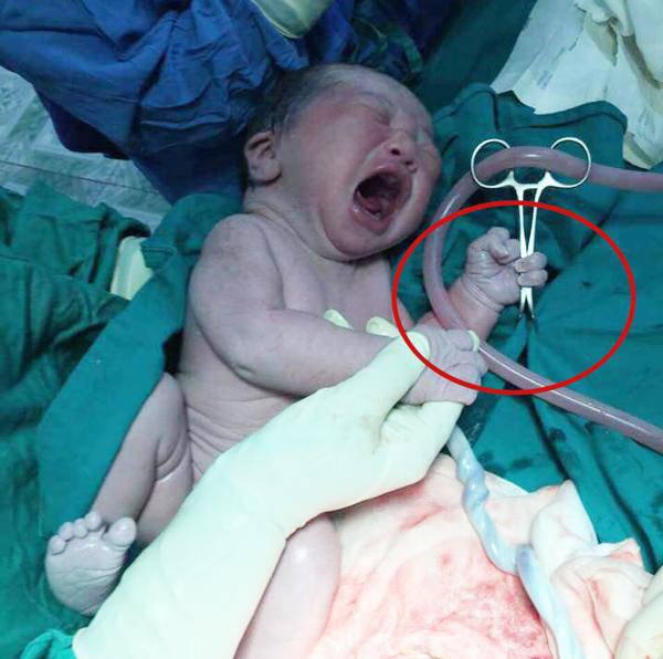 Vừa lọt lòng đã làm “trò hư đốn", bé sơ sinh gây bão - 2