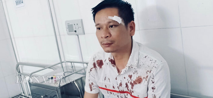 Cty "bốc bát họ" đánh người trước mặt lãnh đạo huyện? - 1