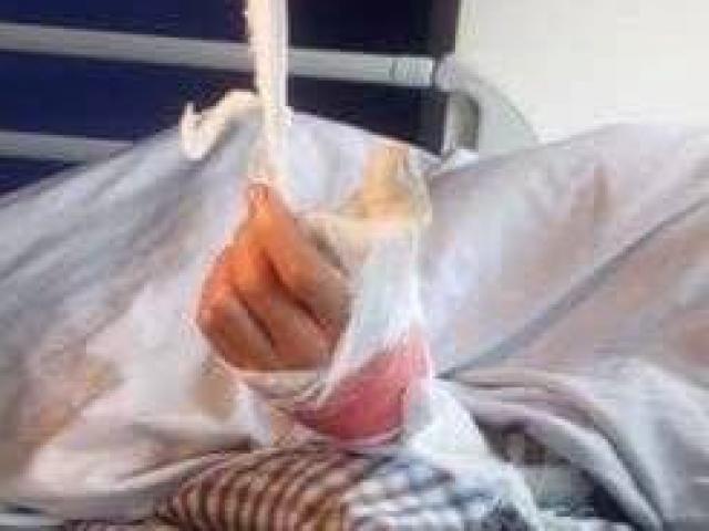 Nhân chứng bàng hoàng kể lại phút nam thanh niên bị chém lìa tay trong...