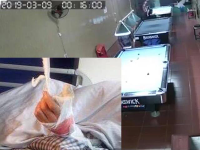 Vụ nam thanh niên bị chém lìa tay: Hé lộ tình tiết bất ngờ từ người thân