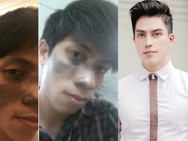 Kỳ tích thay đổi diện mạo đẹp khó tin của 2 chàng trai Ninh Bình, Tiền Giang
