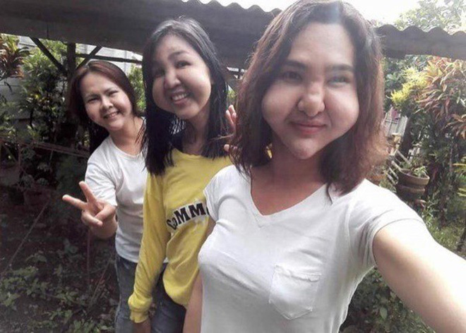 Đôi bạn thân rủ nhau thẩm mỹ chui và cùng biến thành phù thủy - 2