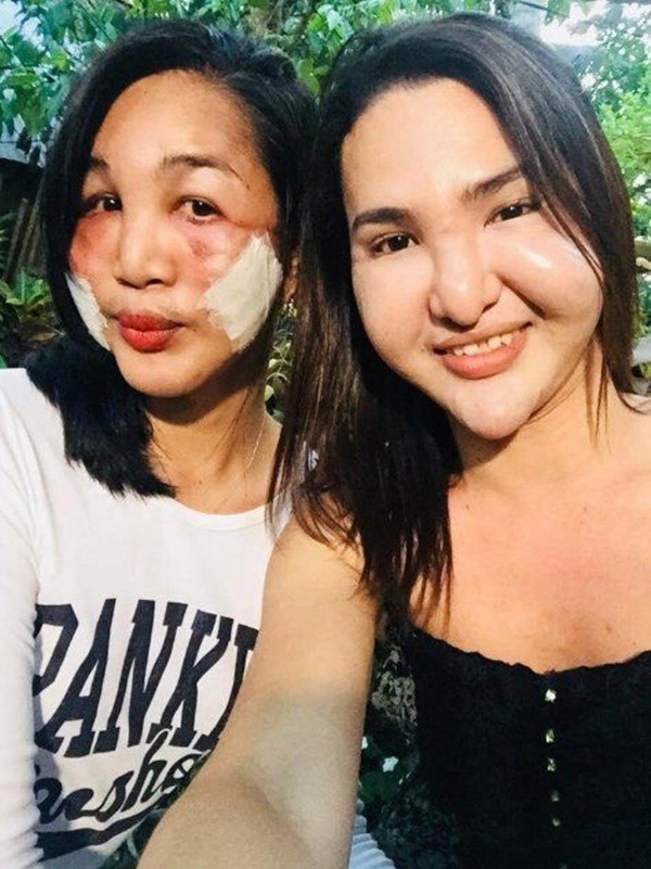 Đôi bạn thân rủ nhau thẩm mỹ chui và cùng biến thành phù thủy - 4