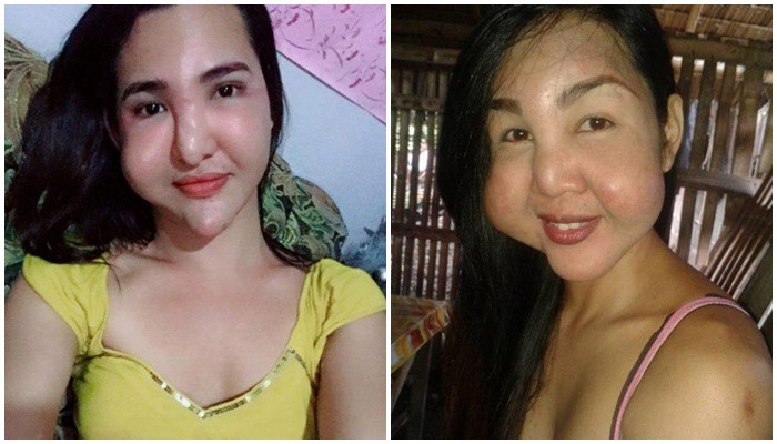 Đôi bạn thân rủ nhau thẩm mỹ chui và cùng biến thành phù thủy - 3
