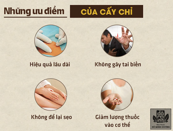 Cấy chỉ vào huyệt - Phương pháp phòng và chữa bệnh nhiều người tin dùng - 4