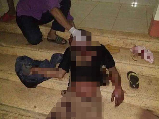 Mâu thuẫn trong lúc nhậu, 2 thanh niên nguy kịch - 1