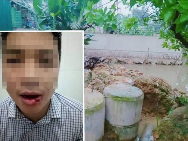 Pháp luật - Thầy giáo ném gãy 5 chiếc răng của nhân viên tòa án