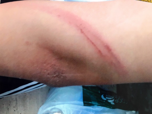 Bình Định: Cha ruột dùng cây đánh con đến tím người phải nhập viện - 2