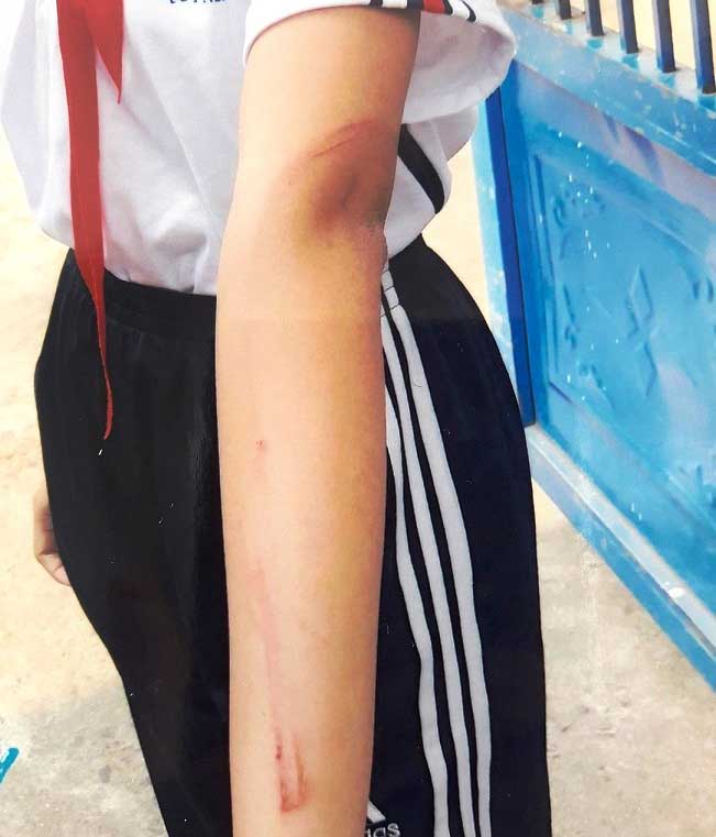 Bình Định: Cha ruột dùng cây đánh con đến tím người phải nhập viện - 3